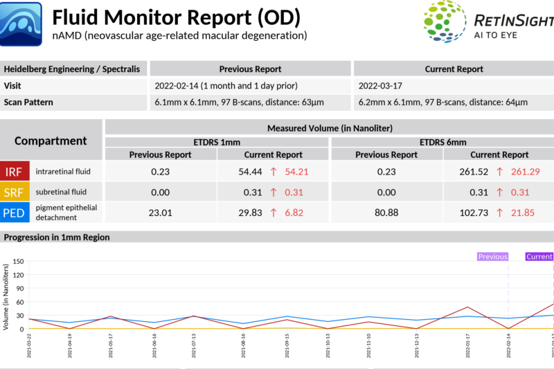 RetInSight Fluid Monitor: Now available with new progression feature 